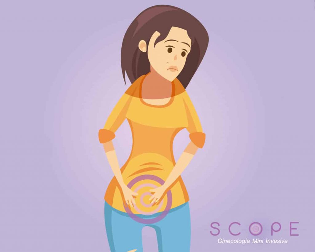 Ooforectomia e Ooforoplastia: causas e tratamentos