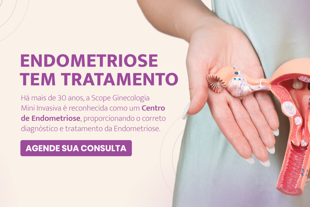 Endometriose tem tratamento Há mais de 30 anos, a Scope Ginecologia Mini Invasiva é reconhecida com um centro de Endometriose, proporcionando o correto diagnóstico e tratamento da Endometriose.